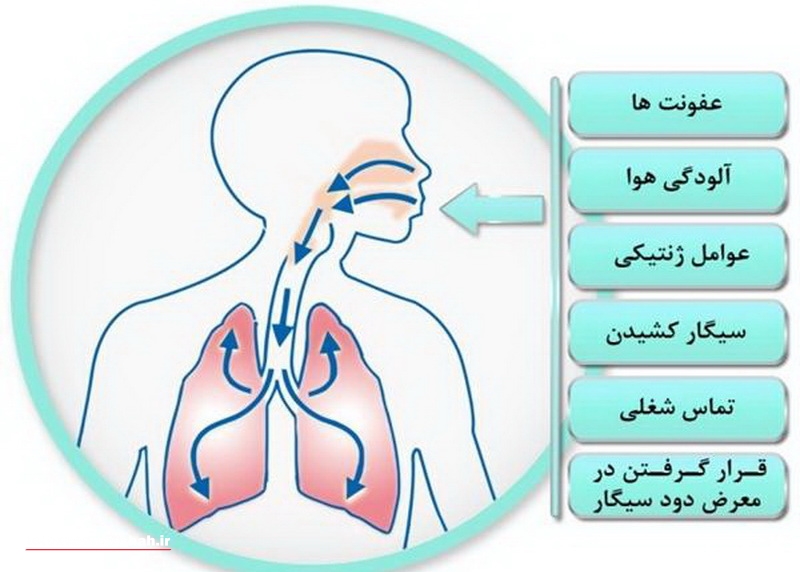 تنباکو از عوامل مهم در بیماری مزمن انسدادی ریه است