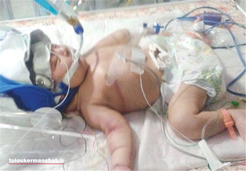انتقال غیراستاندارد عامل کشته شدن نوزادان در کرمانشاه