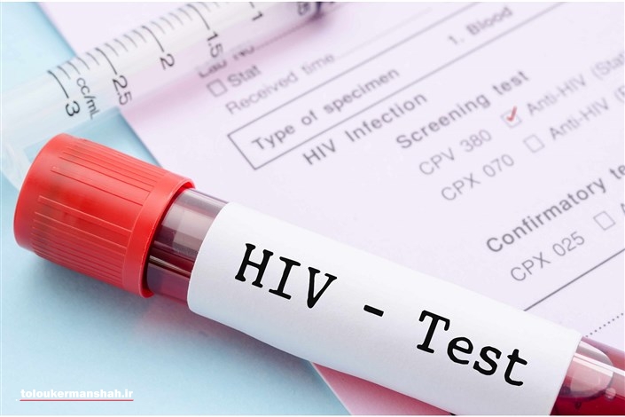 افزایش موارد انتقال افراد به HIV