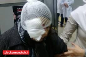 مصدومیت خانم ۲۲ ساله از ناحیه چشم در چهارشنبه سوری کرمانشاه