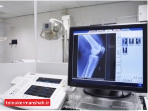 نصب و راه‌اندازی دستگاه جدید رادیولوژی دیجیتال در بیمارستان امام (ره) کرمانشاه