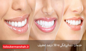 تکذیب فروش کارت تخفیف دندانپزشکی از طرف دانشگاه علوم پزشکی کرمانشاه