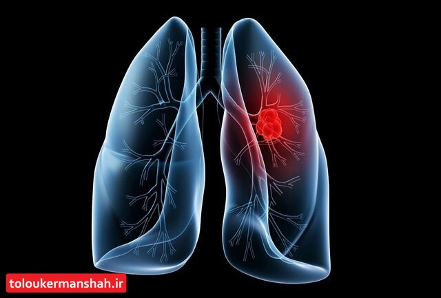یک بیماری با علائم “مشابه کرونا”، اما کُشندهتر!