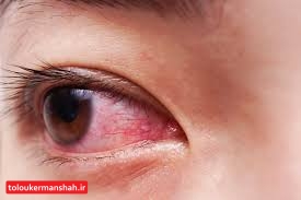 “کرونا” از چشم و گوش وارد بدن میشود؟