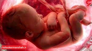 جزئیات طرح جدید مجلس برای سقط جنینی که مشکل جسمی یا ژنتیک دارد