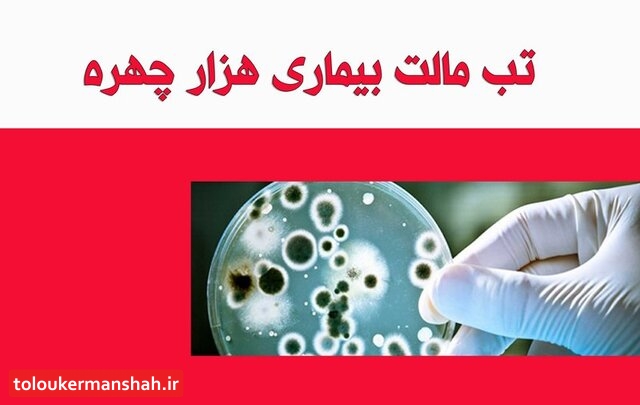 از بیماری “هزارچهره” چه میدانید؟
