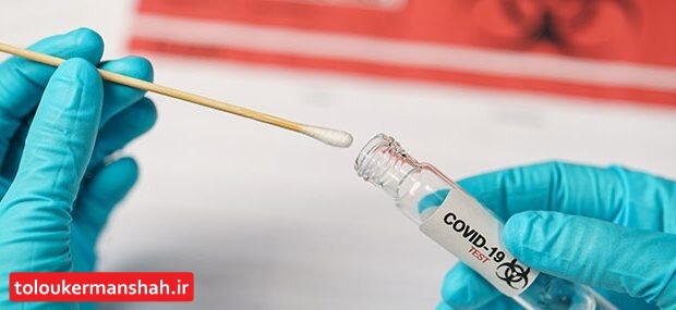 نیاز به انجام تست PCR نیست، علائم کافی است