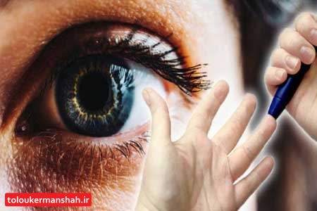 دیابتی ها مراقب افزایش فشار چشم شان باشند