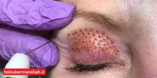 جولان بیقانونی در آرایشگاههای زنانه کرمانشاه/ سالن زیبایی یا مطب دکتر؟