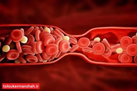 تاثیر فلزات سمی بر افزایش خطر سفت شدگی عروق خونی