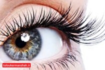 آشنایی با عفونت های چشمی که عواقب وحشتناک دارند