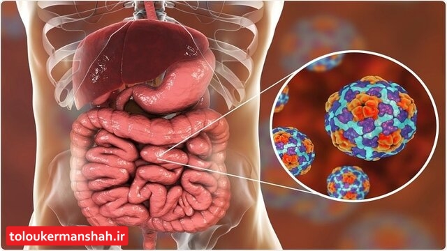 کودکان در فصل گرما در معرض خطر این بیماری هستند