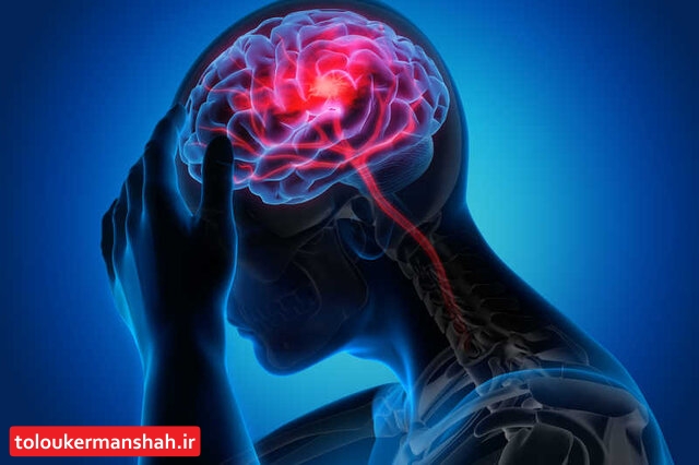 علائم اصلی سکته مغزی چیست؟/ تاثیر میگرن در این بیماری