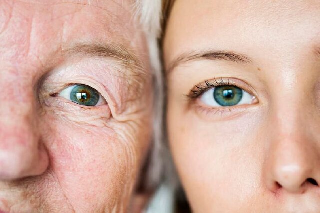 در مورد پیر شدن چشم‌ها بیشتر بدانیم