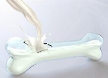 نکاتی برای حفظ سلامت استخوان‌ها