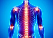 همه چیز درباره التهاب: انواع، علائم، دلایل و روش های درمان