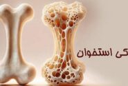 چطور جلوی «پوکی استخوان» را بگیریم؟