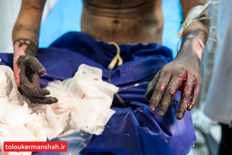 مصدومیت ۵۴ نفر در “چهارشنبه سوری” کرمانشاه/ سوختگی ۱۰۰ درصدی جوان سنقری