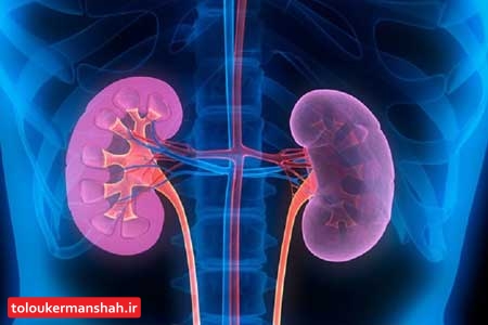 علائمی که میگوید کلیههایتان دچار نارسایی شده است