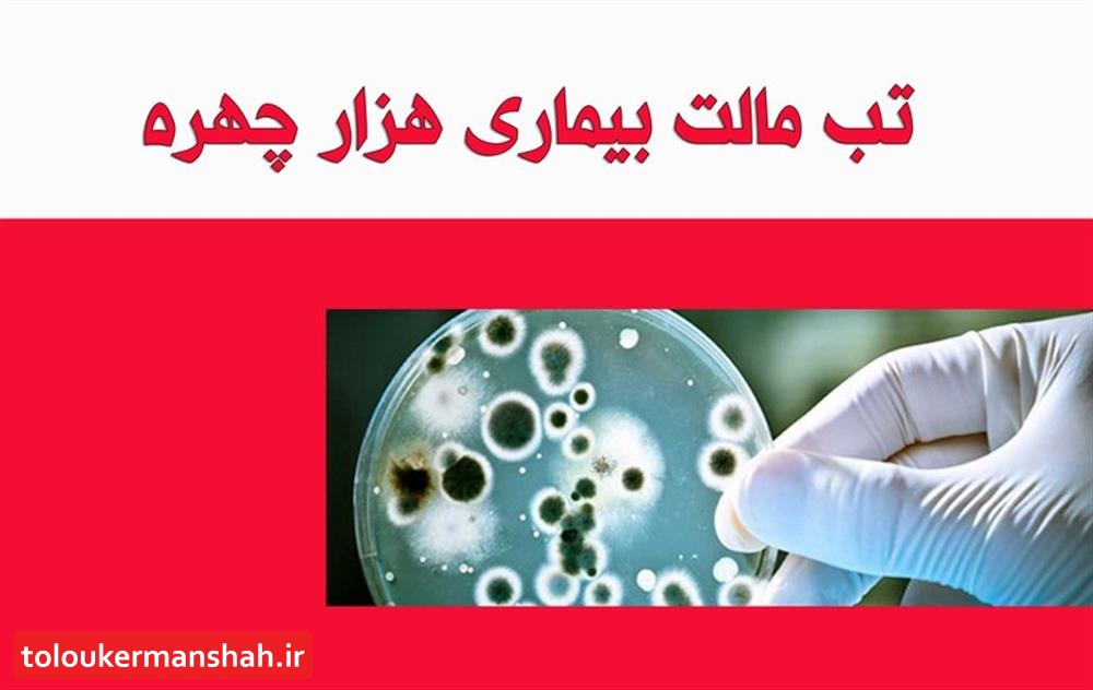 فصل انتقال بیماری تب مالت در اواخر بهار و اوایل تابستان است