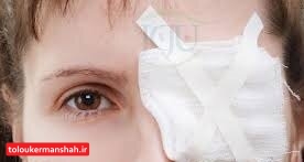 چشمهای “تنبل” را زود شناسایی کنید!