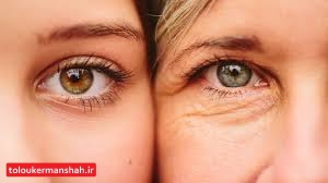 چگونه میتوان از پیرچشمی پیشگیری کرد؟