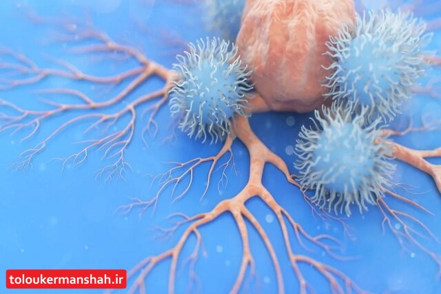 بیش از ۳۰ درصد سرطانها قابل پیشگیری است