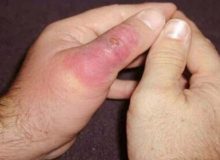 زوار مراقب گزش مار و عقرب باشند