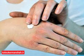 چند توصیه مهم برای مراقبت از پوست در پاییز