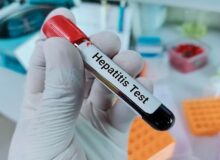 کمتر از ۲۰ درصد مبتلایان به هپاتیت از بیماری خود آگاهند