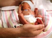 تولد زودرس نوزادان؛ چالشی پنهان در دل زایشگاه‌ها
