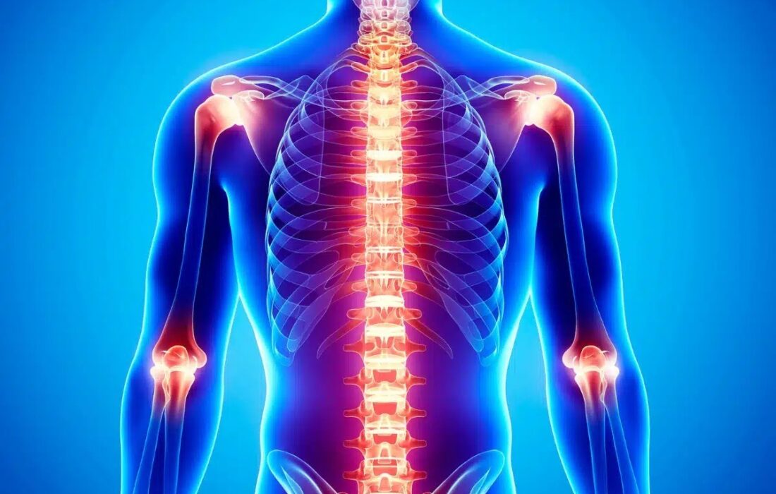 همه چیز درباره التهاب: انواع، علائم، دلایل و روش های درمان